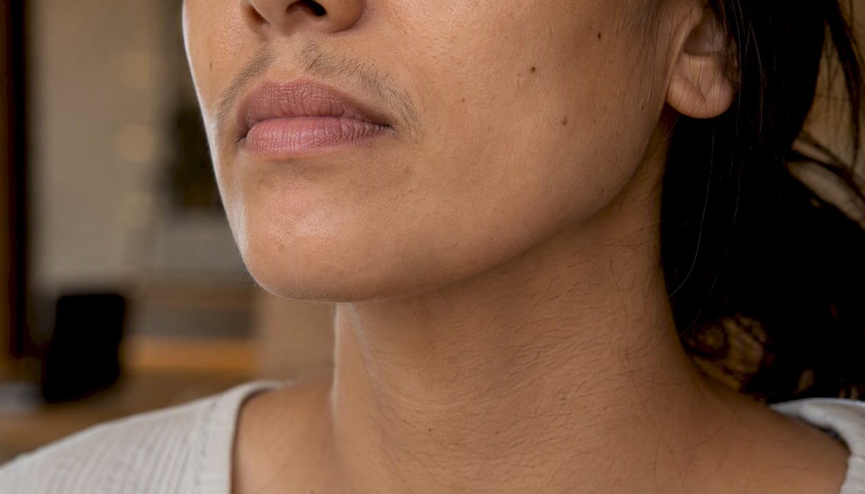 Zoom sur les différentes zones du visage présentant des types de pilosité variés, idéales pour l'épilation au laser.