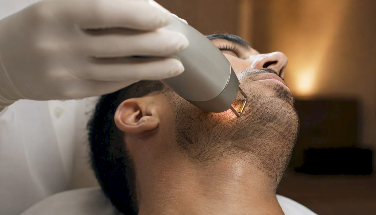 Épilation du visage pour homme au laser médical