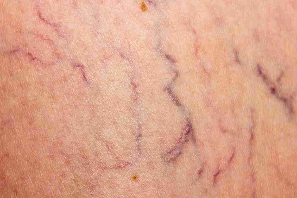 Cabinet de soins laser Laser Derma