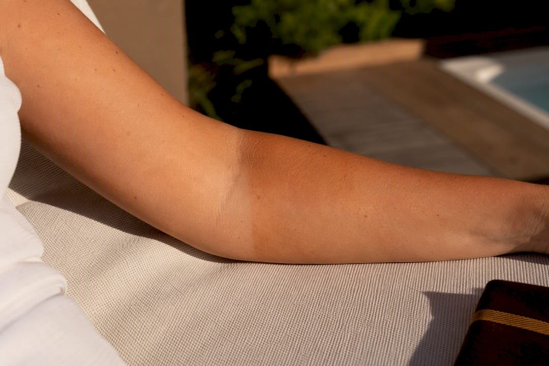 Avant-bras avec une démarcation de bronzage visible