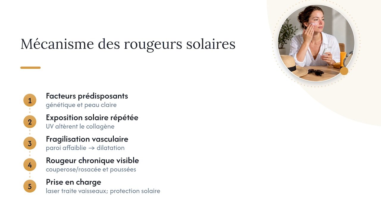 Causes et mécanismes des rougeurs après exposition solaire au visage — overview diagram